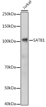 WB analysis of Jurkat cell lysate using GTX55787 SATB1 antibody. Dilution : 1:1000 Loading : 25microg per lane WB analysis of Jurkat cell lysate using GTX55787 SATB1 antibody. Dilution : 1:1000 Loading : 25microg per lane