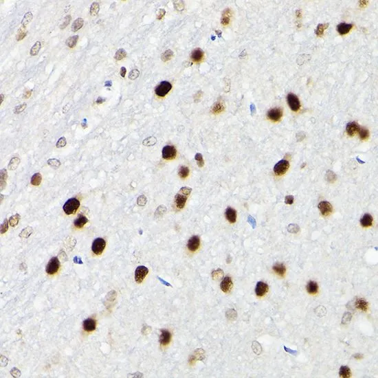 IHC-P analysis of rat brain tissue using GTX55787 SATB1 antibody. Dilution : 1:100