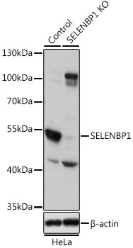 WB analysis of normal (control) and knockout (KO) HeLa cell lysate using GTX55788 SELENBP1 antibody. Dilution : 1:1000 Loading : 25microg per lane WB analysis of normal (control) and knockout (KO) HeLa cell lysate using GTX55788 SELENBP1 antibody. Dilution : 1:1000 Loading : 25microg per lane