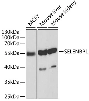 WB analysis of various sample lysates using GTX55788 SELENBP1 antibody. Dilution : 1:1000 Loading : 25microg per lane