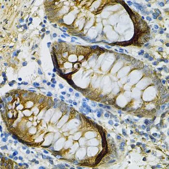 IHC-P analysis of human colon tissue using GTX55788 SELENBP1 antibody. Dilution : 1:100