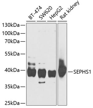 WB analysis of various sample lysates using GTX55789 Selenophosphate synthetase 1 antibody. Dilution : 1:1000 Loading : 25microg per lane WB analysis of various sample lysates using GTX55789 Selenophosphate synthetase 1 antibody. Dilution : 1:1000 Loading : 25microg per lane