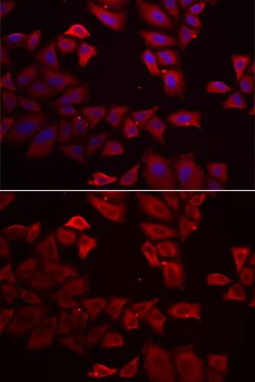 ICC/IF analysis of HeLa cells using GTX55789 Selenophosphate synthetase 1 antibody. Blue : DAPI