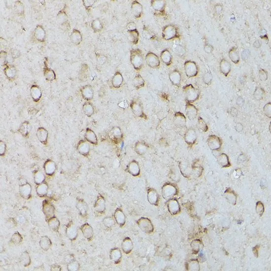 IHC-P analysis of mouse brain tissue using GTX55790 SERCA2 ATPase antibody. Dilution : 1:100