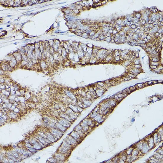 IHC-P analysis of rat brain tissue using GTX55790 SERCA2 ATPase antibody. Dilution : 1:100