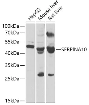 WB analysis of various sample lysates using GTX55791 SERPINA10 antibody. Dilution : 1:1000 Loading : 25microg per lane WB analysis of various sample lysates using GTX55791 SERPINA10 antibody. Dilution : 1:1000 Loading : 25microg per lane