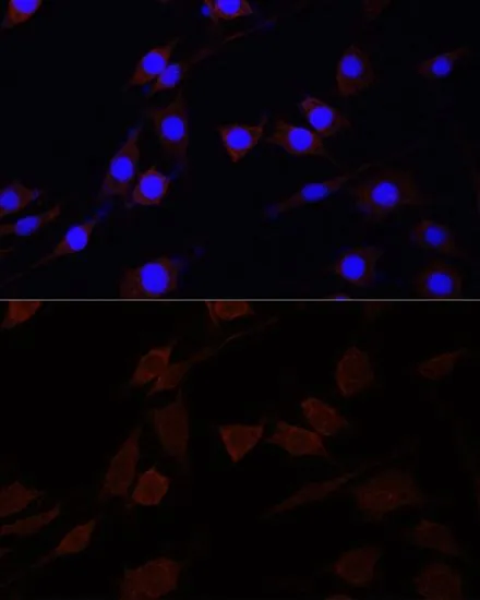 ICC/IF analysis of PC-12 cells using GTX55791 SERPINA10 antibody. Blue : DAPI Dilution : 1:100