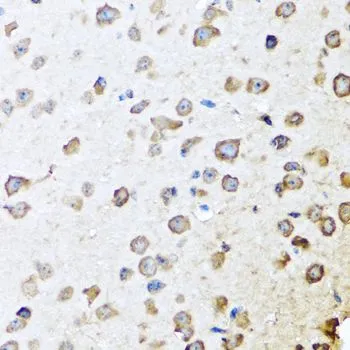 IHC-P analysis of mouse brain tissue using GTX55791 SERPINA10 antibody. Dilution : 1:100