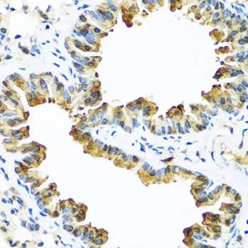 IHC-P analysis of mouse lung tissue using GTX55791 SERPINA10 antibody. Dilution : 1:100