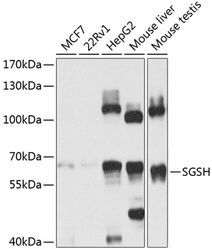 WB analysis of various sample lysates using GTX55796 SGSH antibody. Dilution : 1:1000 Loading : 25microg per lane WB analysis of various sample lysates using GTX55796 SGSH antibody. Dilution : 1:1000 Loading : 25microg per lane