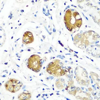 IHC-P analysis of human stomach tissue using GTX55796 SGSH antibody. Dilution : 1:100