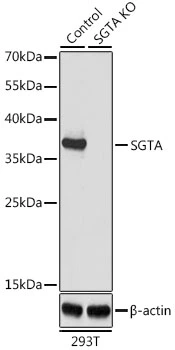 WB analysis of normal (control) and knockout (KO) 293T cell lysate using GTX55797 SGTA antibody. Dilution : 1:1000 Loading : 25microg per lane WB analysis of normal (control) and knockout (KO) 293T cell lysate using GTX55797 SGTA antibody. Dilution : 1:1000 Loading : 25microg per lane