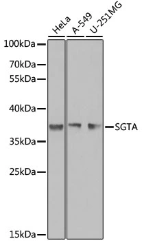 WB analysis of various sample lysates using GTX55797 SGTA antibody. Dilution : 1:1000 Loading : 25microg per lane