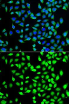 ICC/IF analysis of A549 cells using GTX55797 SGTA antibody. Blue : DAPI