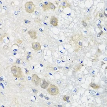 IHC-P analysis of rat brain tissue using GTX55798 SHMT1 antibody. Dilution : 1:100