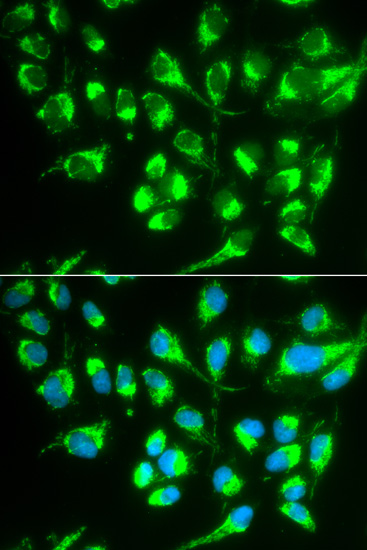 ICC/IF analysis of MCF-7 cell using GTX55800 SLC22A5 antibody. Blue : DAPI
