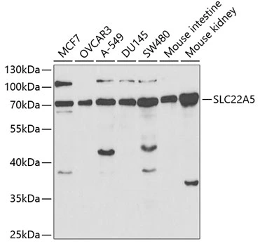 WB analysis of various sample lysates using GTX55800 SLC22A5 antibody. Dilution : 1:1000 Loading : 25microg per lane WB analysis of various sample lysates using GTX55800 SLC22A5 antibody. Dilution : 1:1000 Loading : 25microg per lane