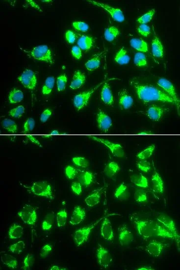 ICC/IF analysis of MCF7 cells using GTX55800 SLC22A5 antibody. Blue : DAPI