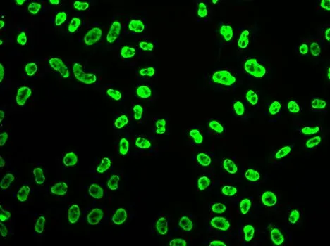 ICC/IF analysis of HeLa cells using GTX55804 SNRPA antibody.