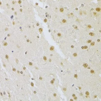 IHC-P analysis of mouse brain tissue using GTX55804 SNRPA antibody. Dilution : 1:100