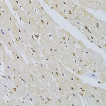 IHC-P analysis of rat heart tissue using GTX55804 SNRPA antibody. Dilution : 1:100
