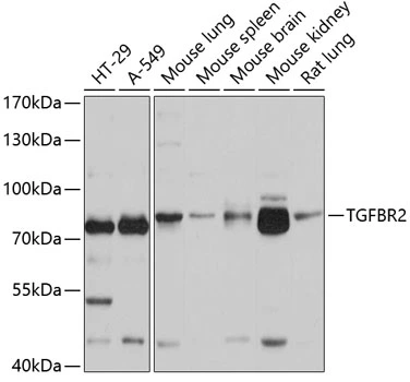 WB analysis of various sample lysates using GTX55814 TGF beta Receptor 2 antibody. Dilution : 1:1000 Loading : 25microg per lane WB analysis of various sample lysates using GTX55814 TGF beta Receptor 2 antibody. Dilution : 1:1000 Loading : 25microg per lane
