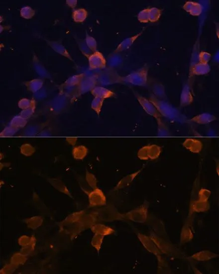 ICC/IF analysis of NIH/3T3 cells using GTX55814 TGF beta Receptor 2 antibody. Blue : DAPI Dilution : 1:100