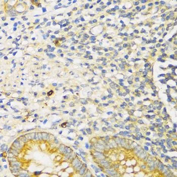 IHC-P analysis of human appendix tissue using GTX55814 TGF beta Receptor 2 antibody. Dilution : 1:100