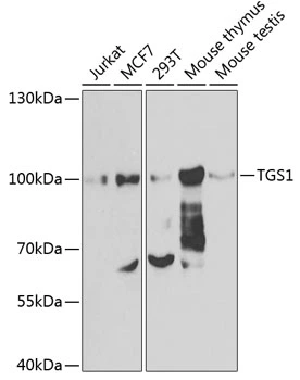 WB analysis of various sample lysates using GTX55815 PIMT antibody. Dilution : 1:1000 Loading : 25microg per lane WB analysis of various sample lysates using GTX55815 PIMT antibody. Dilution : 1:1000 Loading : 25microg per lane