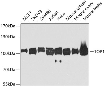Rat tissue extract (50 ug) was separated by 7.5% SDS-PAGE,and the membrane was blotted with Topoisomerase I antibody (GTX55820) diluted at 1:500. The HRP-conjugated anti-rabbit IgG antibody (GTX213110-01) was used to detect the primary antibody.