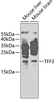 WB analysis of various sample lysates using GTX55821 Trefoil Factor 3 antibody. The signal was developed with ECL plus-Enhanced. Dilution : 1:1000 Loading : 25microg per lane WB analysis of various sample lysates using GTX55821 Trefoil Factor 3 antibody. The signal was developed with ECL plus-Enhanced. Dilution : 1:1000 Loading : 25microg per lane