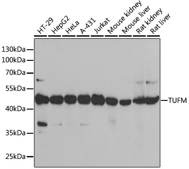 WB analysis of various sample lysates using GTX55825 TUFM antibody. Dilution : 1:1000 Loading : 25microg per lane