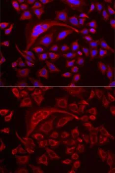 ICC/IF analysis of MCF7 cells using GTX55825 TUFM antibody. Blue : DAPI