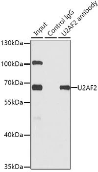 IP analysis of SW620 cell lysate using GTX55828 U2AF65 antibody. Antibody amount : 1microg / 200microg lysate Dilution : 1:500 IP analysis of SW620 cell lysate using GTX55828 U2AF65 antibody. Antibody amount : 1microg / 200microg lysate Dilution : 1:500