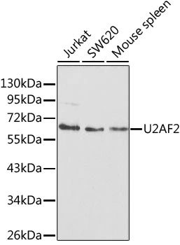 WB analysis of various sample lysates using GTX55828 U2AF65 antibody. Dilution : 1:1000 Loading : 25microg per lane