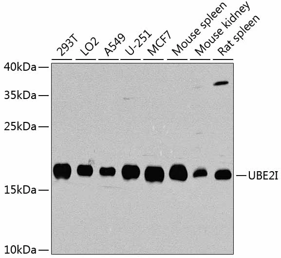 WB analysis of various sample lysates using GTX55830 UBE2I antibody. Dilution : 1:1000 Loading : 25microg per lane WB analysis of various sample lysates using GTX55830 UBE2I antibody. Dilution : 1:1000 Loading : 25microg per lane
