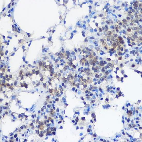 IHC-P analysis of rat brain tissue using GTX55830 UBE2I antibody. Dilution : 1:100