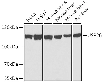 WB analysis of various sample lysates using GTX55837 USP26 antibody. Dilution : 1:1000 Loading : 25microg per lane WB analysis of various sample lysates using GTX55837 USP26 antibody. Dilution : 1:1000 Loading : 25microg per lane