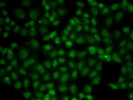 ICC/IF analysis of A549 cells using GTX55837 USP26 antibody.