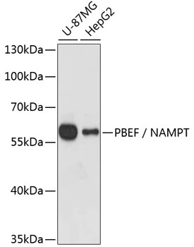 WB analysis of various sample lysates using GTX55840 Visfatin antibody. Dilution : 1:1000 Loading : 25microg per lane WB analysis of various sample lysates using GTX55840 Visfatin antibody. Dilution : 1:1000 Loading : 25microg per lane