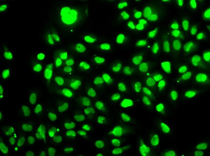 ICC/IF analysis of HeLa cells using GTX55840 Visfatin antibody.