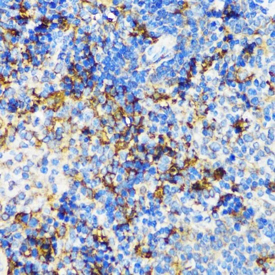 IHC-P analysis of mouse spleen tissue using GTX55840 Visfatin antibody. Dilution : 1:100