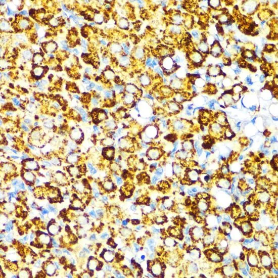 IHC-P analysis of rat ovary tissue using GTX55840 Visfatin antibody. Dilution : 1:100