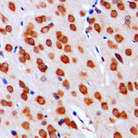 IHC-P analysis of formalin fixed human brain tissue section using GTX55856 DGKA antibody. Antigen retrieval : Heat mediated antigen retrieval with sodium citrate buffer (pH 6.0)