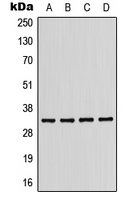 WB analysis of MDA-MB-231 (A), Jurkat (B), mouse liver (C), H9C2 (D) whole cell lysates using GTX55865 KIR2DL2 antibody. WB analysis of MDA-MB-231 (A), Jurkat (B), mouse liver (C), H9C2 (D) whole cell lysates using GTX55865 KIR2DL2 antibody.