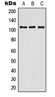 WB analysis of HEK293T (A), SP2/0 (B), H9C2 (C) whole cell lysates using GTX55875 Contactin 3 antibody. WB analysis of HEK293T (A), SP2/0 (B), H9C2 (C) whole cell lysates using GTX55875 Contactin 3 antibody.