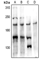 WB analysis of various samples using GTX55884 PTP kappa antibody. Lane A: HCT116 whole cell lysate Lane B: A549 whole cell lysate Lane C: mouse lung tissue lysate Lane D: rat brain tissue lysate WB analysis of various samples using GTX55884 PTP kappa antibody. Lane A: HCT116 whole cell lysate Lane B: A549 whole cell lysate Lane C: mouse lung tissue lysate Lane D: rat brain tissue lysate