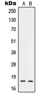 WB analysis of NCI-H460 (A), HeLa (B) whole cell lysates using GTX55887 RNASE3 antibody. WB analysis of NCI-H460 (A), HeLa (B) whole cell lysates using GTX55887 RNASE3 antibody.
