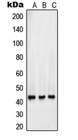 WB analysis of HepG2 (A), Y79 (B), A549 (C) whole cell lysates using GTX55891 Surfactant Protein B antibody. WB analysis of HepG2 (A), Y79 (B), A549 (C) whole cell lysates using GTX55891 Surfactant Protein B antibody.