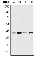 WB analysis of HeLa (A), Jurkat (B), Raw264.7 (C), PC12 (D) whole cell lysates using GTX55892 SIX3 antibody. WB analysis of HeLa (A), Jurkat (B), Raw264.7 (C), PC12 (D) whole cell lysates using GTX55892 SIX3 antibody.